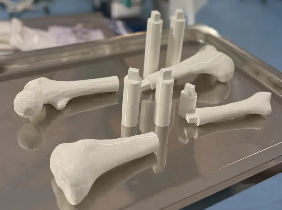 Kit modular impreso en 3D sobre una bandeja metálica: piezas óseas blancas de fémur y tibia y varios anillos cilíndricos para ajustar la longitud.