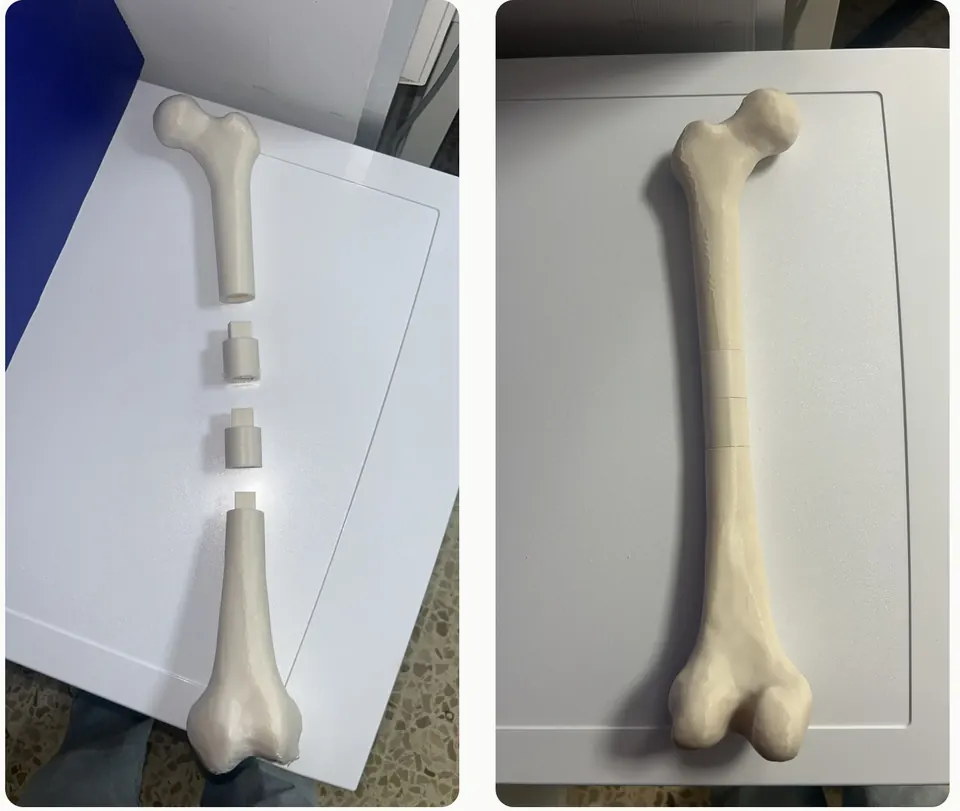 Dos fotografías de un fémur impreso en 3D: a la izquierda, desmontado en pieza proximal, dos anillos y pieza distal; a la derecha, montado.