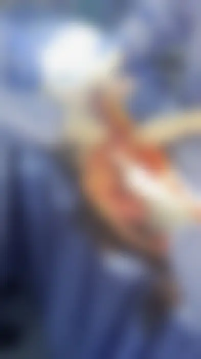 Fotograma difuminado del vídeo de colocación del kit